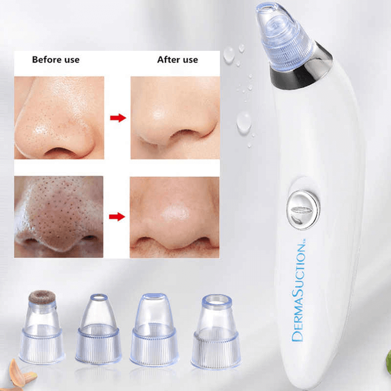 Derma suction cell operated black head remover