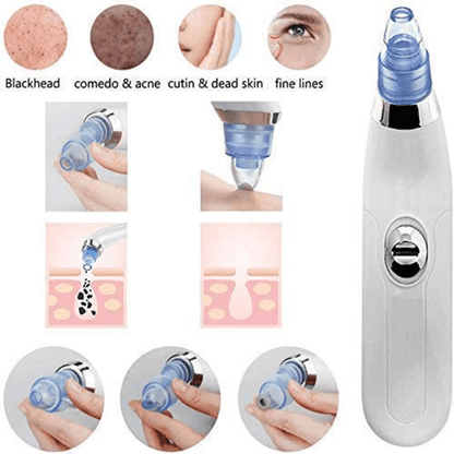 Derma suction cell operated black head remover