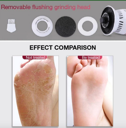 Callus remover with built-in vacuum electric foot grinder