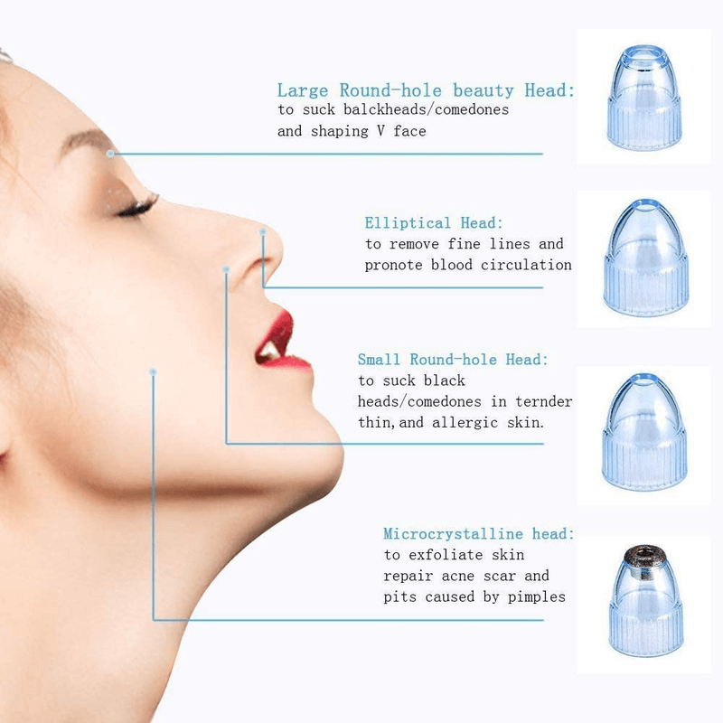 Electric suction blackhead remover pore cleanser