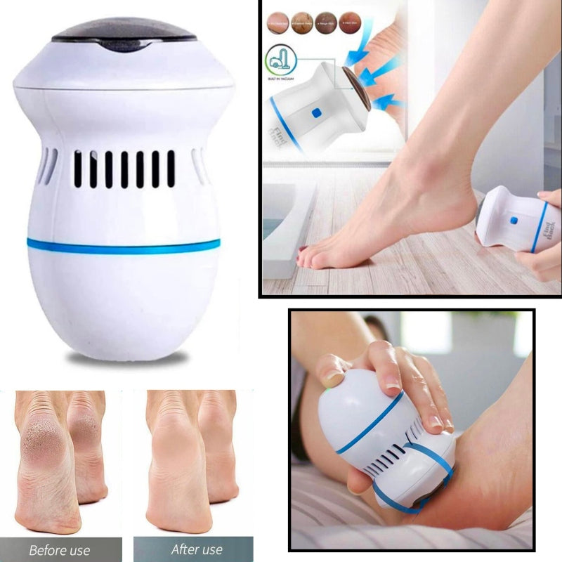 Callus remover with built-in vacuum electric foot grinder